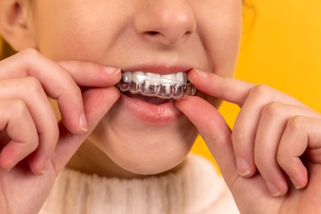 The Different Types of Teeth Whitening Treatments
