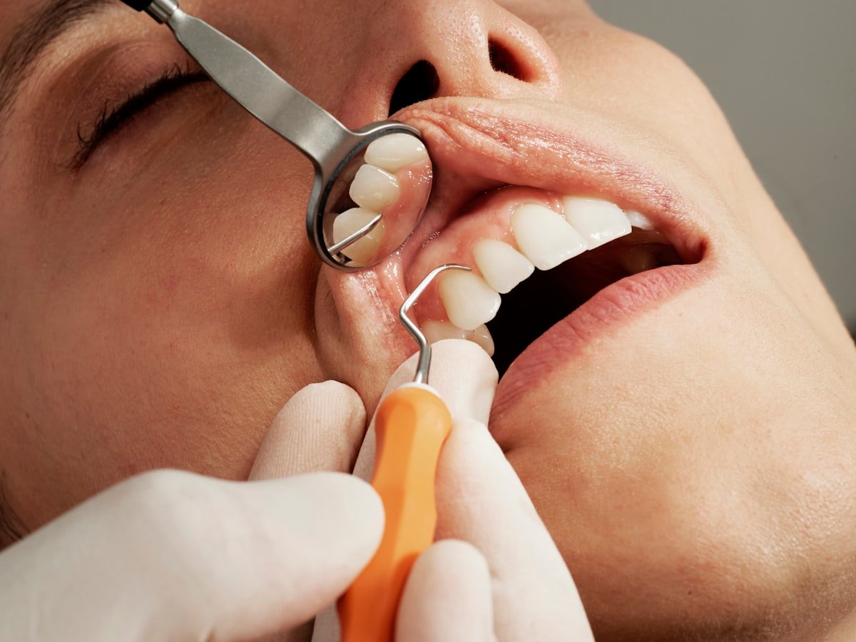 Full and Partial Dentures
